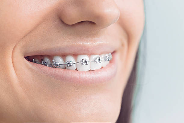 Laser Dentistry in Owingsville, KY